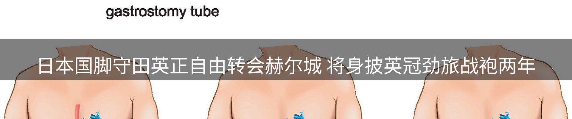 新闻消息